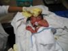 Baby`s 1st bath at hospital